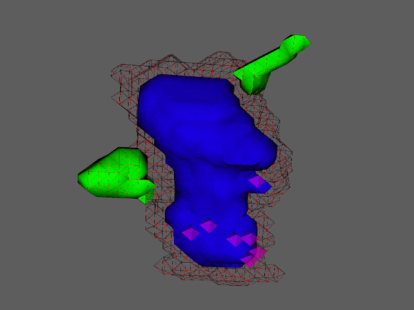 LEAP: Advanced Lesion Analysis in Multiple&nbsp;Sclerosis